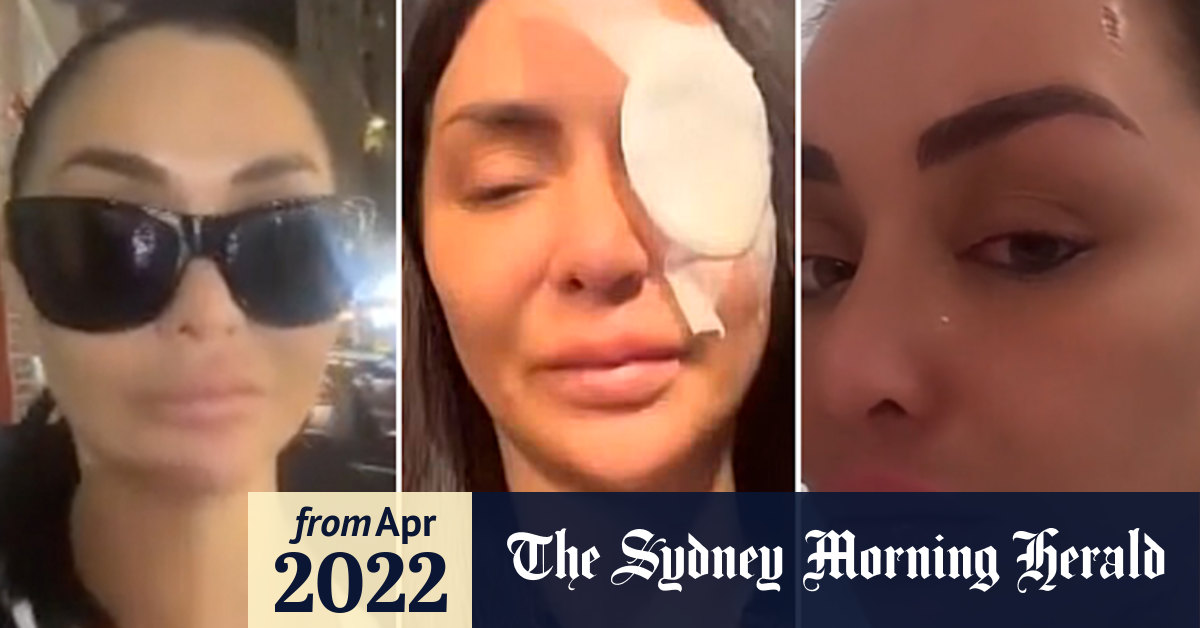 TikTok personality Jenny Elhassan the victim of alleged acid attack in Sydney